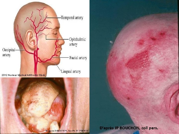 2012 Nucleus Medical Art/Doctor Stock D’après JP BOUCHON, coll pers. 
