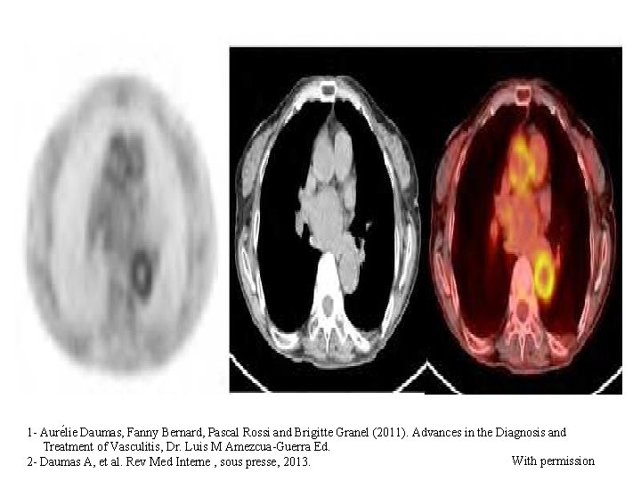 1 - Aure lie Daumas, Fanny Bernard, Pascal Rossi and Brigitte Granel (2011). Advances