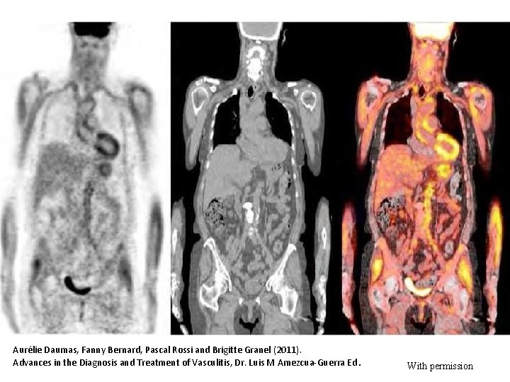 Aure lie Daumas, Fanny Bernard, Pascal Rossi and Brigitte Granel (2011). Advances in the