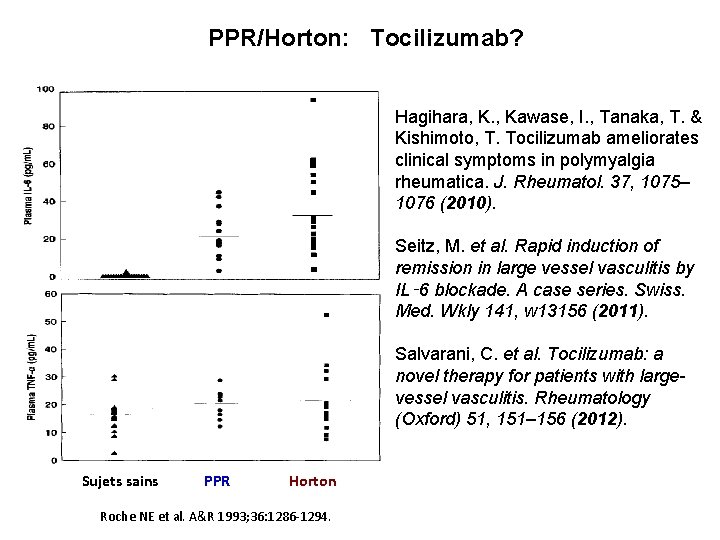 PPR/Horton: Tocilizumab? Hagihara, K. , Kawase, I. , Tanaka, T. & Kishimoto, T. Tocilizumab