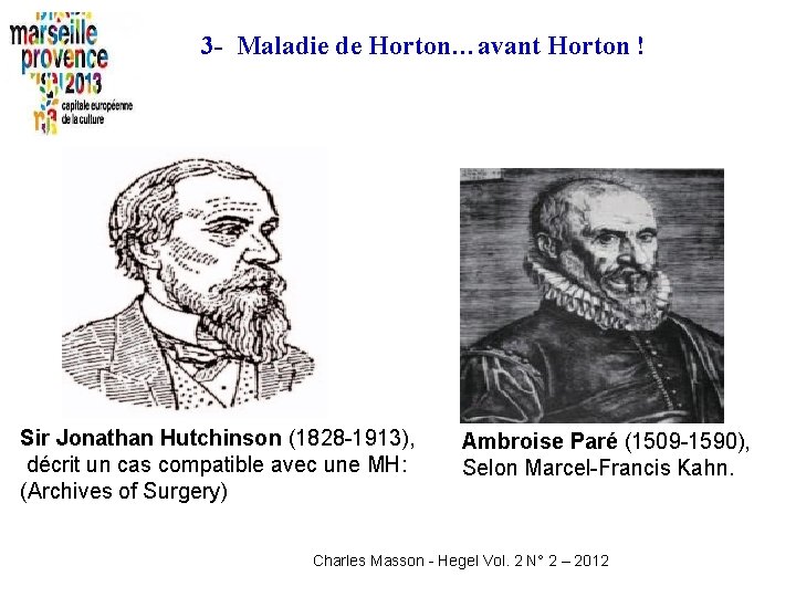 3 - Maladie de Horton…avant Horton ! Sir Jonathan Hutchinson (1828 -1913), décrit un