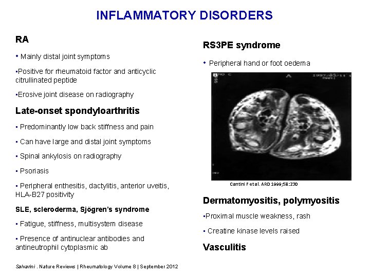 INFLAMMATORY DISORDERS RA • Mainly distal joint symptoms • Positive for rheumatoid factor and