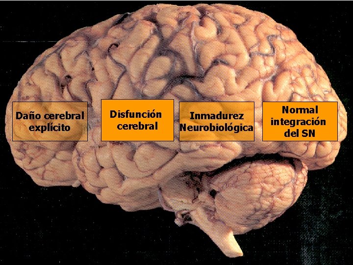 Daño cerebral explícito Disfunción cerebral Inmadurez Neurobiológica Normal integración del SN Daño cerebral explícito Disfunción cerebral Inmadurez Neurobiológica Normal integración del SN