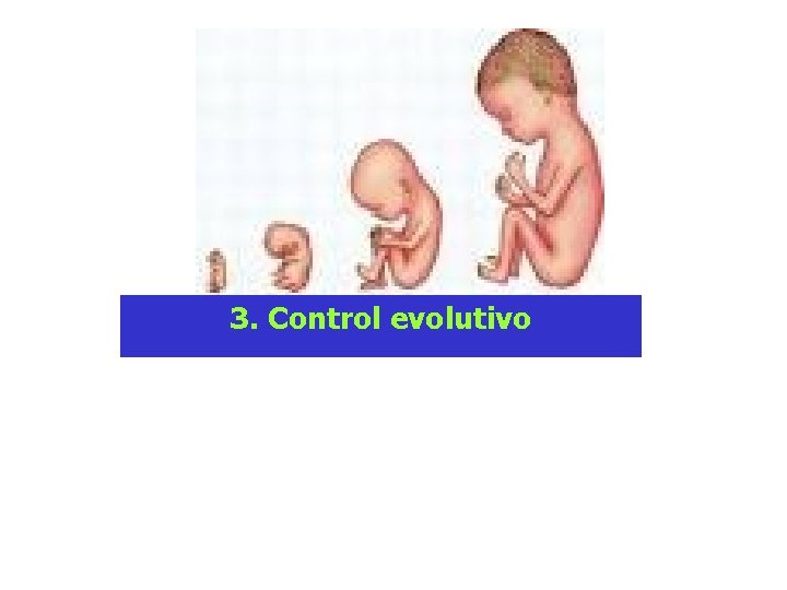 3. Control evolutivo 3. Control evolutivo