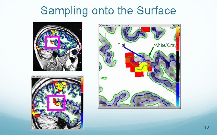 Sampling onto the Surface Pial White/Gray 10 