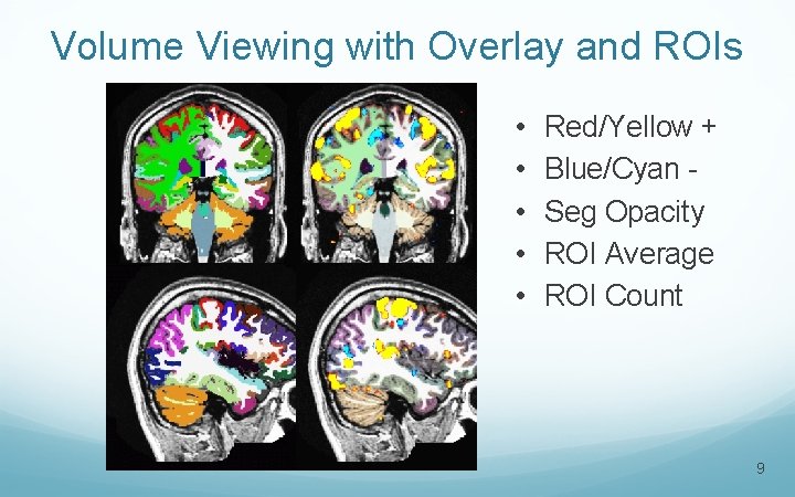Volume Viewing with Overlay and ROIs • • • Red/Yellow + Blue/Cyan Seg Opacity