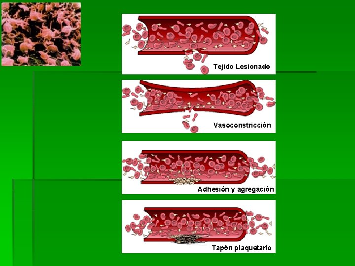 Tejido Lesionado Vasoconstricción Adhesión y agregación Tapón plaquetario 