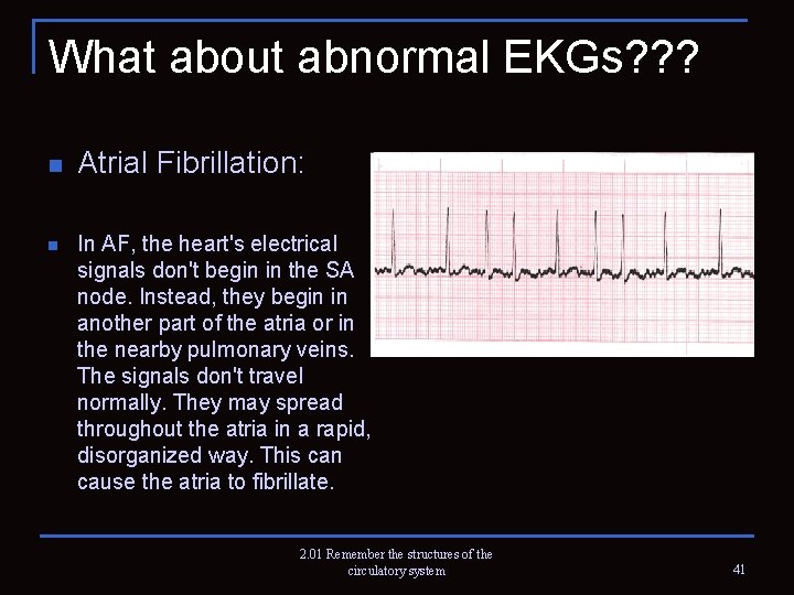 What about abnormal EKGs? ? ? n n Atrial Fibrillation: In AF, the heart's