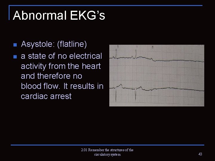 Abnormal EKG’s n n Asystole: (flatline) a state of no electrical activity from the