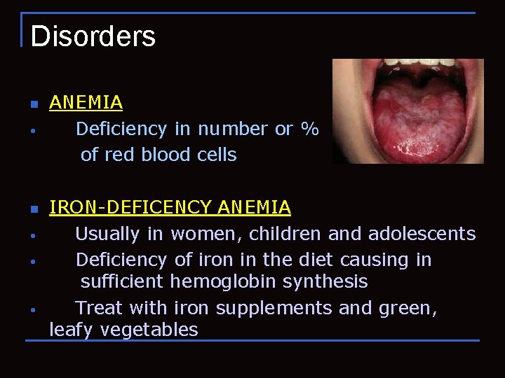 Disorders n • • • ANEMIA Deficiency in number or % of red blood