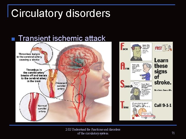 Circulatory disorders n Transient ischemic attack 2. 02 Understand the functions and disorders of