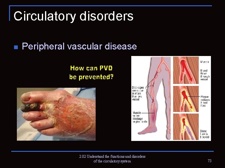 Circulatory disorders n Peripheral vascular disease 2. 02 Understand the functions and disorders of