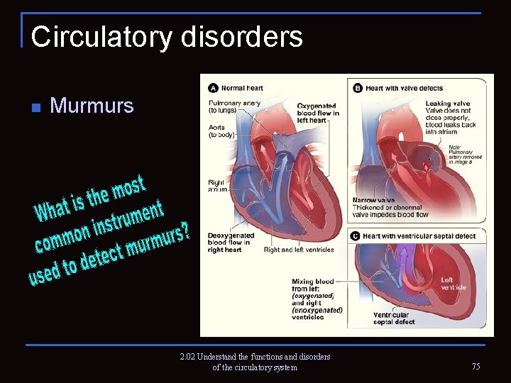 Circulatory disorders n Murmurs 2. 02 Understand the functions and disorders of the circulatory