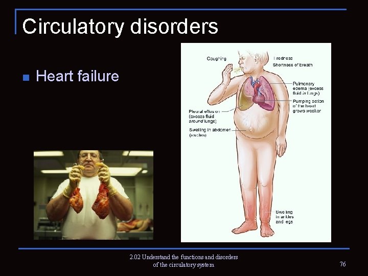 Circulatory disorders n Heart failure 2. 02 Understand the functions and disorders of the