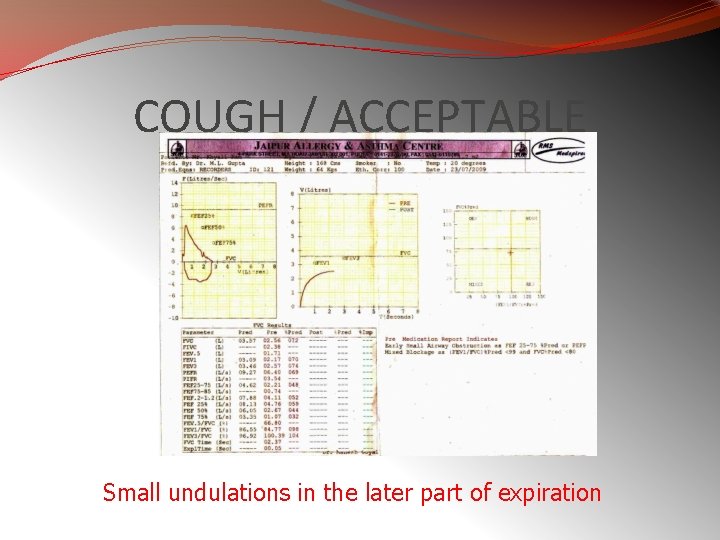 COUGH / ACCEPTABLE Small undulations in the later part of expiration 