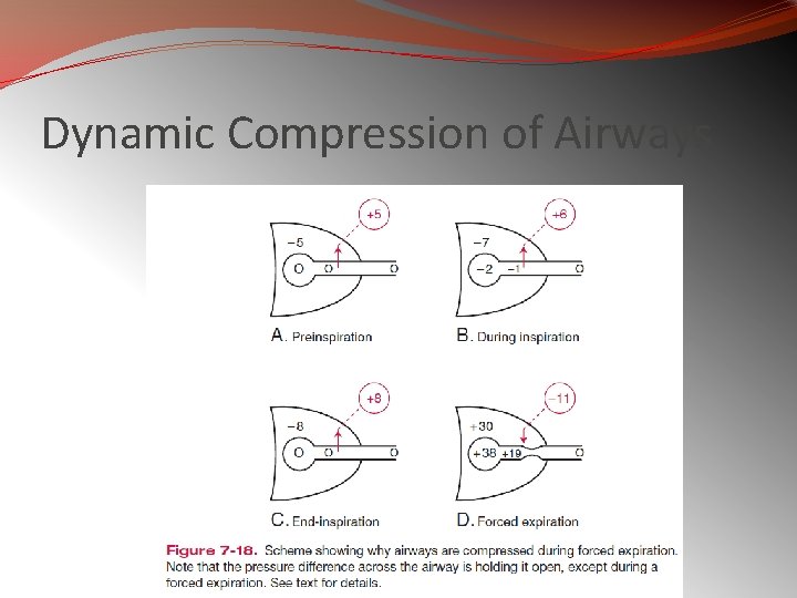 Dynamic Compression of Airways 