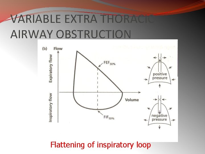 VARIABLE EXTRA THORACIC AIRWAY OBSTRUCTION Flattening of inspiratory loop 