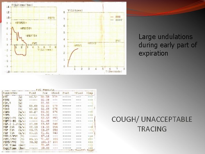 Large undulations during early part of expiration COUGH/ UNACCEPTABLE TRACING 