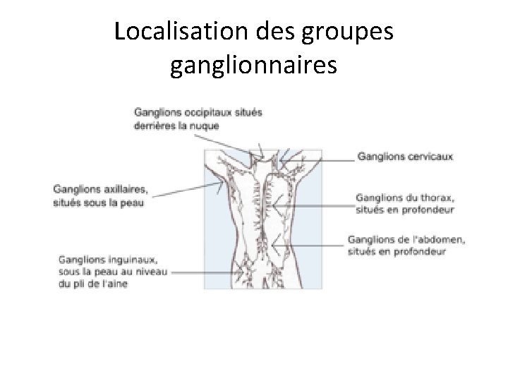 Localisation des groupes ganglionnaires 