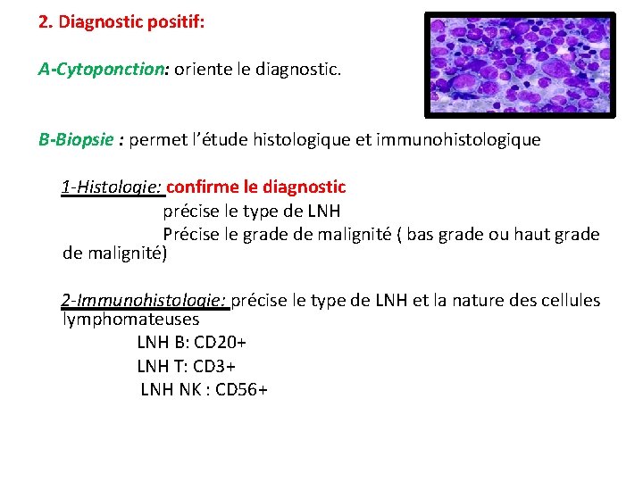 2. Diagnostic positif: A-Cytoponction: oriente le diagnostic. B-Biopsie : permet l’étude histologique et immunohistologique