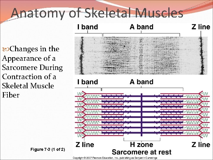 Anatomy of Skeletal Muscles Changes in the Appearance of a Sarcomere During Contraction of