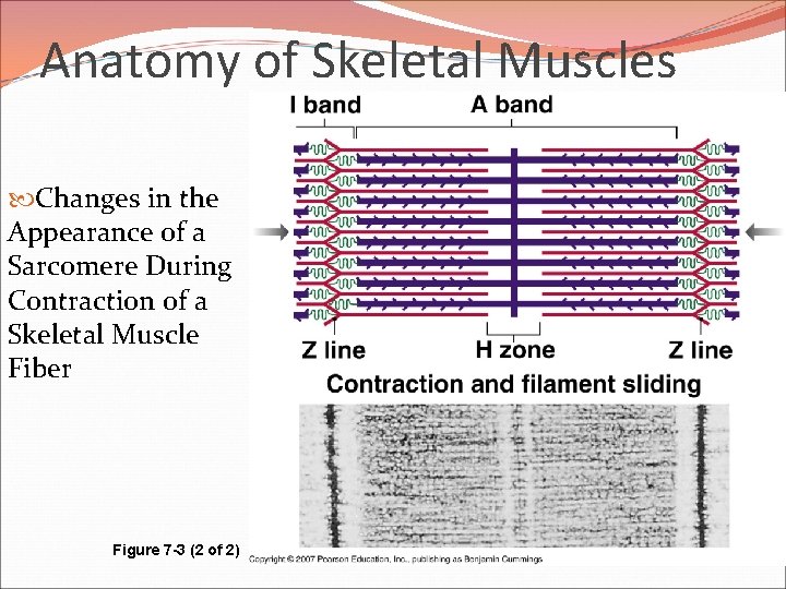 Anatomy of Skeletal Muscles Changes in the Appearance of a Sarcomere During Contraction of