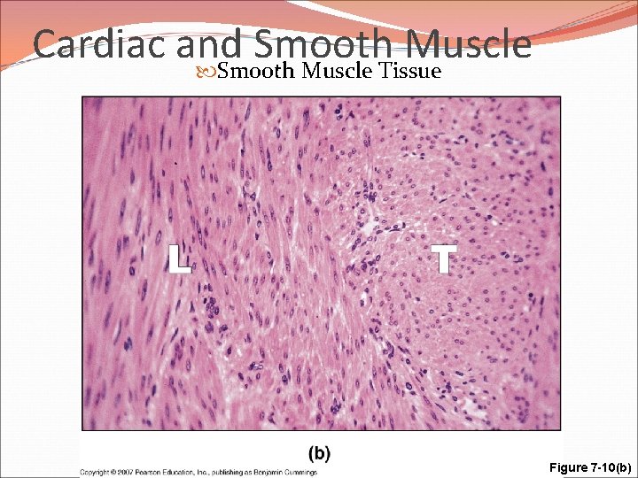 Cardiac and Smooth Muscle Tissue Figure 7 -10(b) 