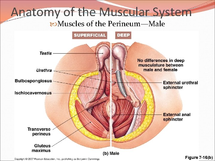 Anatomy of the Muscular System Muscles of the Perineum—Male Figure 7 -16(b) 