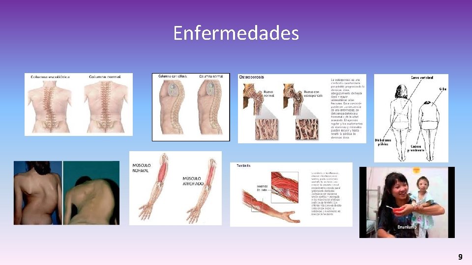 Enfermedades 9 Enfermedades 9