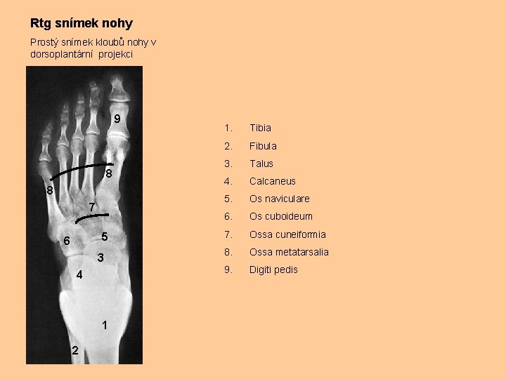Rtg snímek nohy Prostý snímek kloubů nohy v dorsoplantární projekci 9 8 8 7