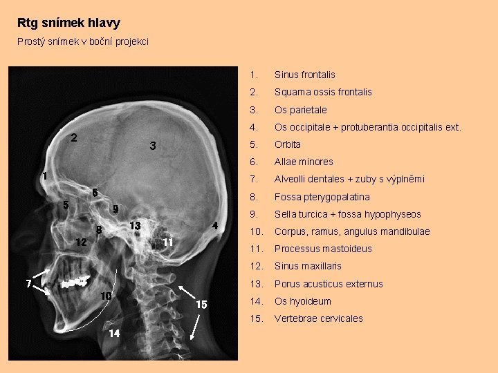 Rtg snímek hlavy Prostý snímek v boční projekci 2 3 1 6 5 9