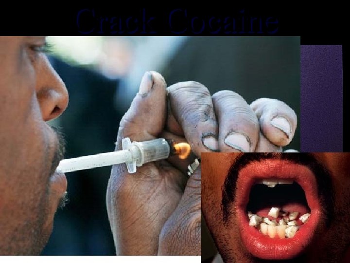 Crack Cocaine 