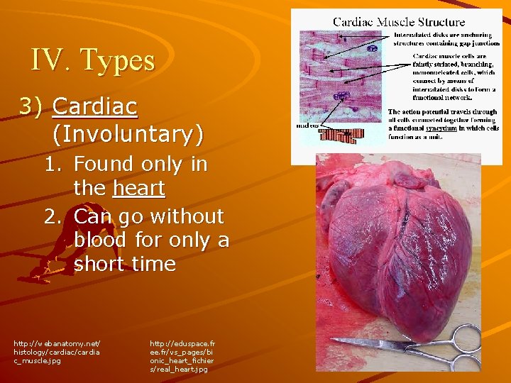 IV. Types 3) Cardiac (Involuntary) 1. Found only in the heart 2. Can go