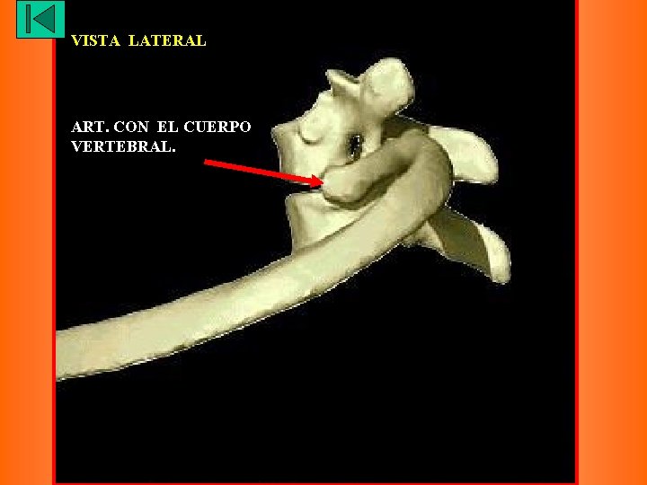 VISTA LATERAL ART. CON EL CUERPO VERTEBRAL. 