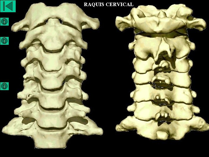 RAQUIS CERVICAL 