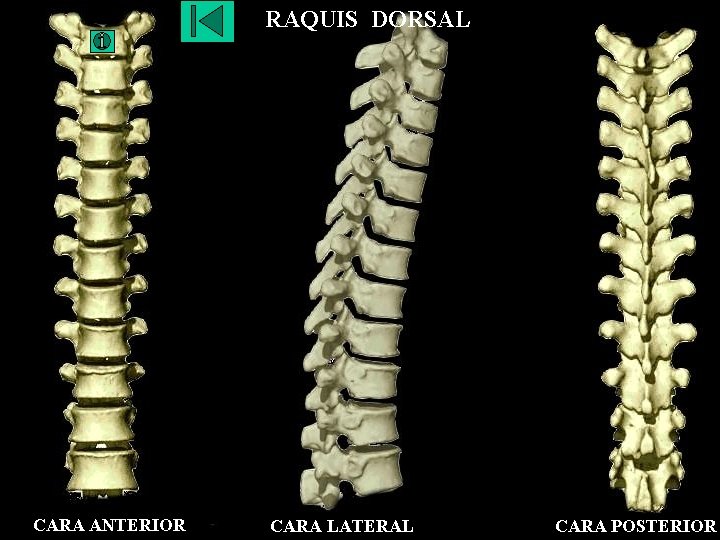 RAQUIS DORSAL CARA ANTERIOR CARA LATERAL CARA POSTERIOR 