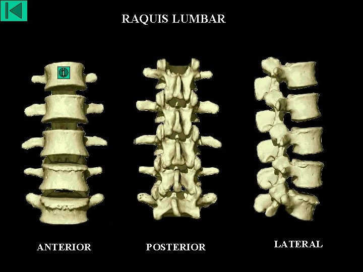 RAQUIS LUMBAR ANTERIOR POSTERIOR LATERAL 