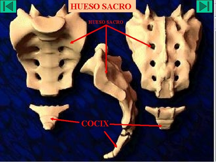 HUESO SACRO COCIX 