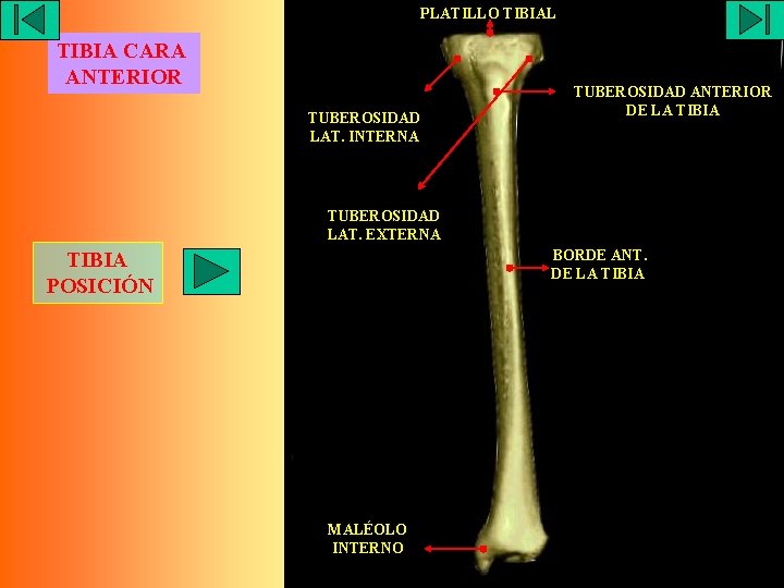 PLATILLO TIBIAL TIBIA CARA ANTERIOR TUBEROSIDAD LAT. INTERNA TUBEROSIDAD ANTERIOR DE LA TIBIA TUBEROSIDAD