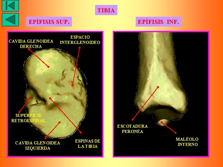 TIBIA EPÍFISIS SUP. CAVIDA GLENOIDEA DERECHA EPÍFISIS INF. ESPACIO INTERGLENOIDEO SUPERFICIE RETROESPINAL ESCOTADURA PERONÉA