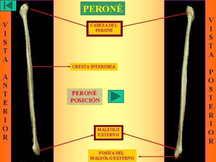 PERONÉ V I S T A CABEZA DEL PERONÉ CRESTA INTEROSEA A N T