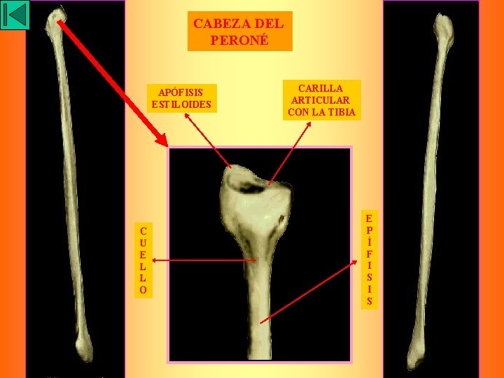 CABEZA DEL PERONÉ APÓFISIS ESTILOIDES C U E L L O CARILLA ARTICULAR CON