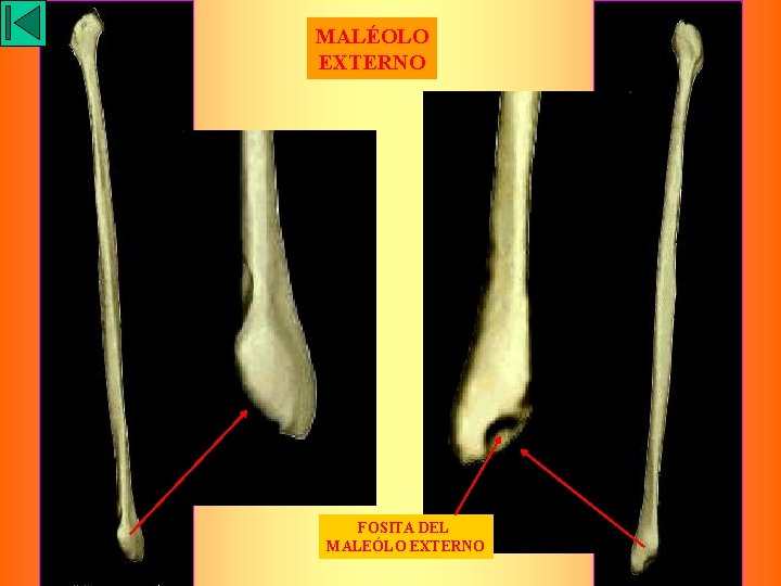 MALÉOLO EXTERNO FOSITA DEL MALEÓLO EXTERNO 