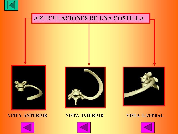ARTICULACIONES DE UNA COSTILLA VISTA ANTERIOR VISTA INFERIOR VISTA LATERAL 