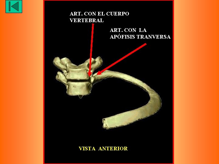 ART. CON EL CUERPO VERTEBRAL ART. CON LA APÓFISIS TRANVERSA VISTA ANTERIOR 