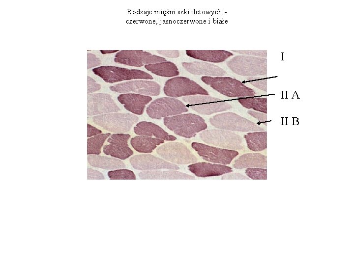Rodzaje mięśni szkieletowych czerwone, jasnoczerwone i białe I II A II B 