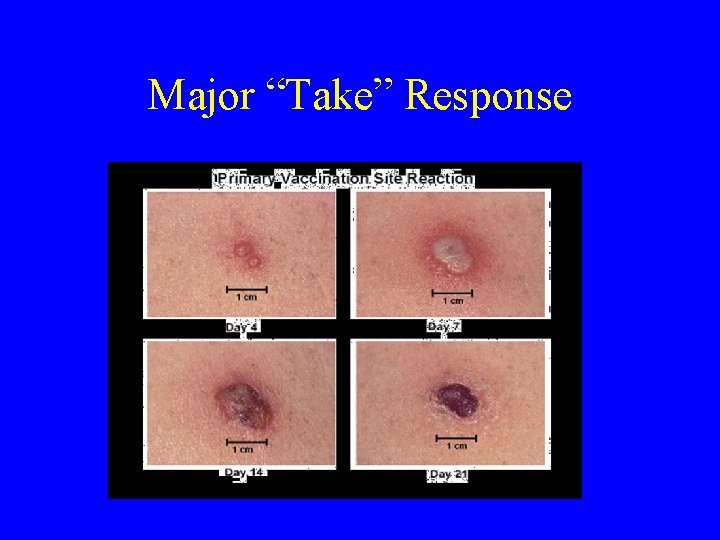 Major “Take” Response 