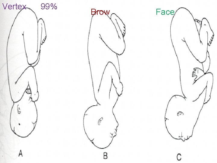 Vertex 99% Brow Face 11 