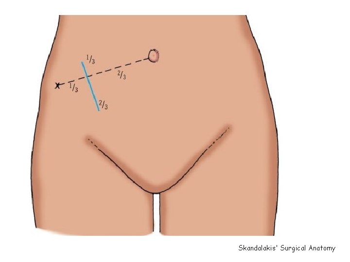 Skandalakis' Surgical Anatomy 