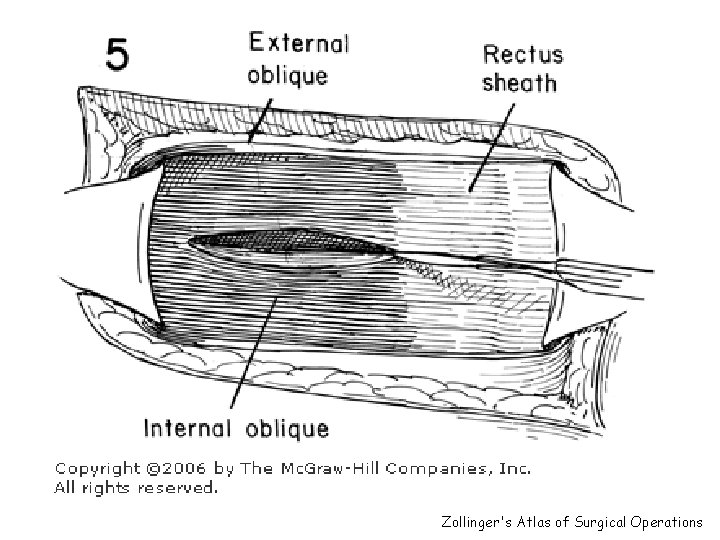 Zollinger's Atlas of Surgical Operations 